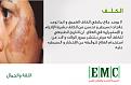 اضغط على الصورة لعرض أكبر. 

الإسم:	melasma1.jpg 
مشاهدات:	102 
الحجم:	100.0 &#1603;&#1610;&#1604;&#1608;&#1576;&#1575;&#1610;&#1578; 
الهوية:	10794500