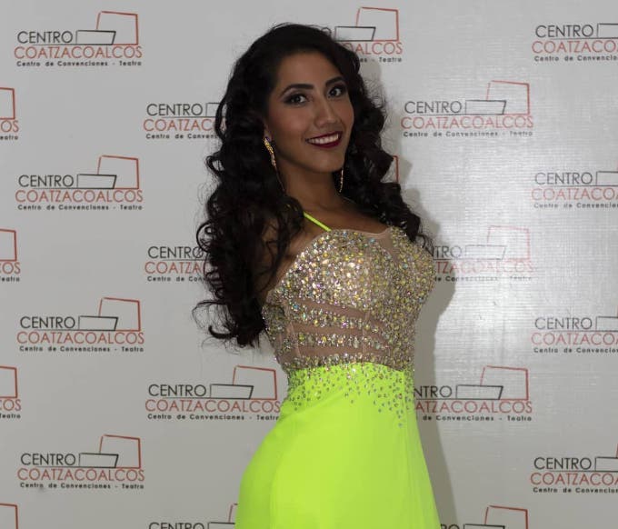 طموحها اللقب.. مكسيكية بلا ذراعين تكسر قواعد الجمال