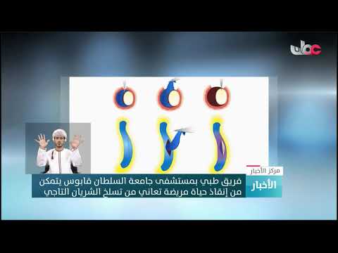 فريق طبي بمستشفى جامعة السلطان قابوس يتمكن من إنقاذ حياة مريضة تعاني من تسلخ الشريان التاجي