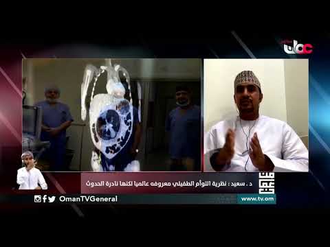 إنجاز طبي عماني لحالة نادرة الحدوث عالميا
