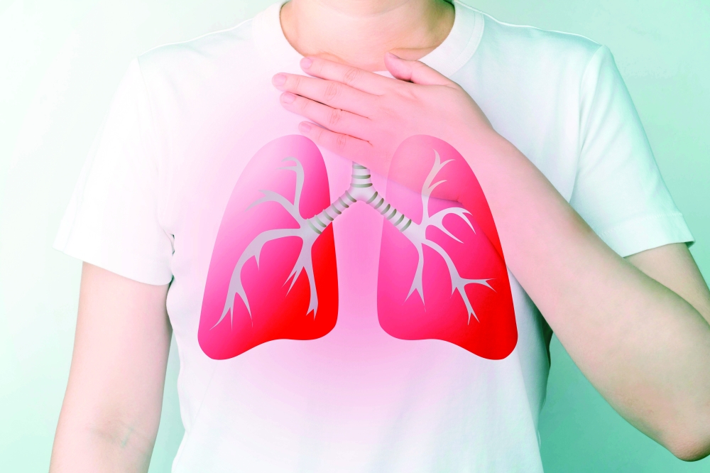 Chronic cough torments Covid-recovered patients