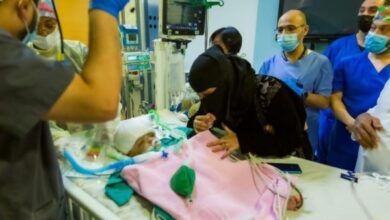 Saudi doctors separate conjoined twins in Yemen