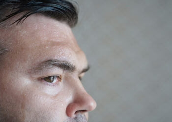 How to manage stress sweat