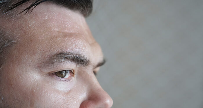 How to manage stress sweat