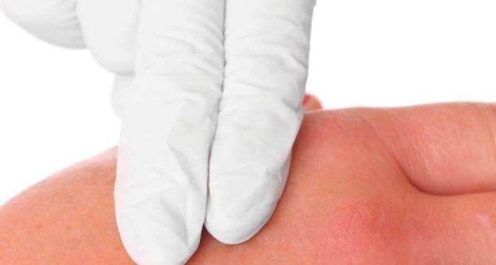 How one woman took control of her rare disease and achieved her dream 1 How one woman took control of her rare disease and achieved her dream