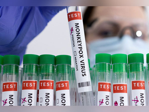 “We believe Monkeypox outbreak can be stopped”: WHO