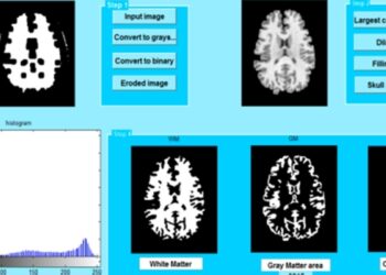 فريق بحثي عُماني يطوّر برنامجًا ذكيًّا يُساعد في تشخيص مرض الزهايمر عبر تقنيات الذكاء الاصطناعي