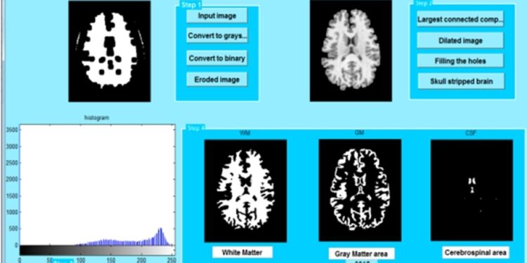فريق بحثي عُماني يطوّر برنامجًا ذكيًّا يُساعد في تشخيص مرض الزهايمر عبر تقنيات الذكاء الاصطناعي 1 فريق بحثي عُماني يطوّر برنامجًا ذكيًّا يُساعد في تشخيص مرض الزهايمر عبر تقنيات الذكاء الاصطناعي