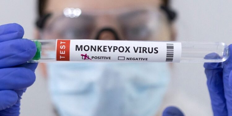 نيوزيلندا تسجل أول إصابة بفيروس جدري القرود 1 نيوزيلندا تسجل أول إصابة بفيروس جدري القرود