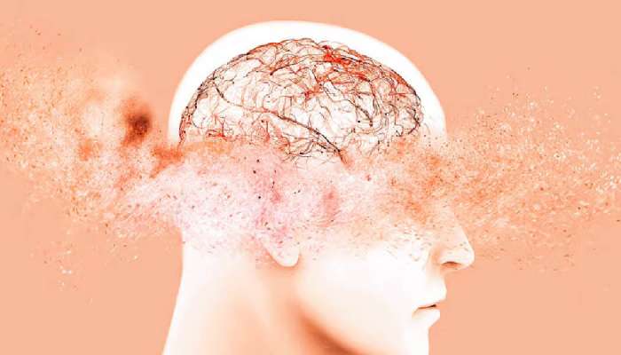 Study finds new approach to prevent dementia