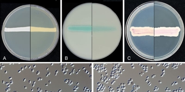 Nizwa University develops therapy for Candida Auris infection