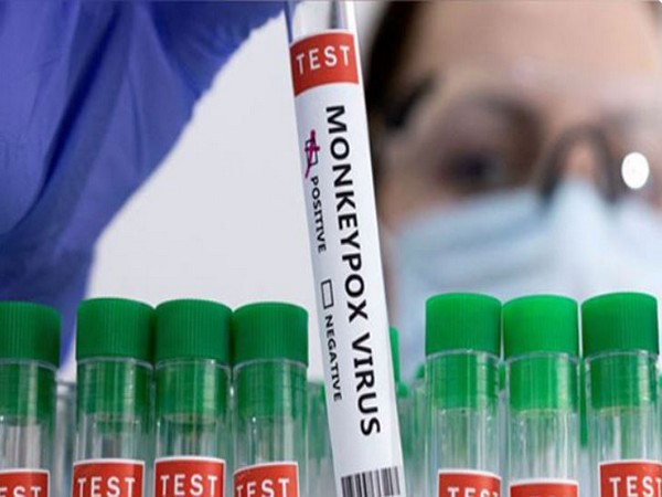 New Monkeypox strain identified in UK