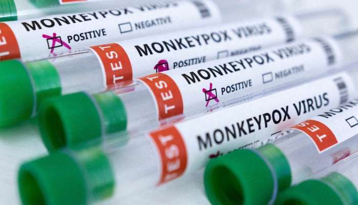 First Monkeypox case reported in Bahrain