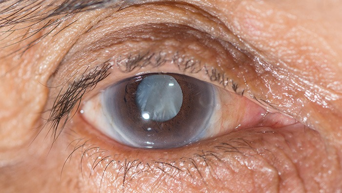 Prioritising vision health for healthy ageing