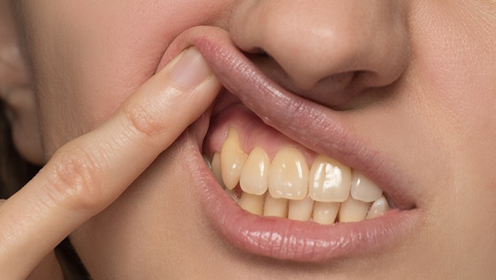 Notice yellow teeth? Might not be what you think