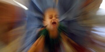 Measles becomes ‘an imminent global threat’ due to the Covid pandemic: WHO