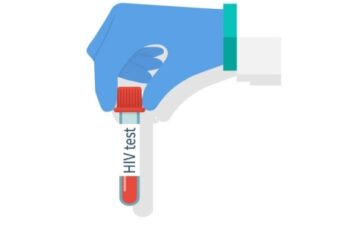 HIV testing confidential, assures MoH