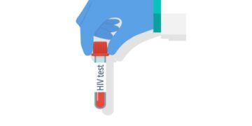 HIV testing confidential, assures MoH