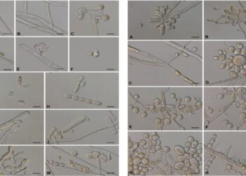 إنجاز علمي عالمي جديد لجامعة نزوى في مجال استكشاف الفطريات الطبية بإسم “Mucor germinans”