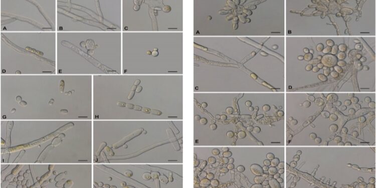 إنجاز علمي عالمي جديد لجامعة نزوى في مجال استكشاف الفطريات الطبية بإسم "Mucor germinans" 1 إنجاز علمي عالمي جديد لجامعة نزوى في مجال استكشاف الفطريات الطبية بإسم “Mucor germinans”